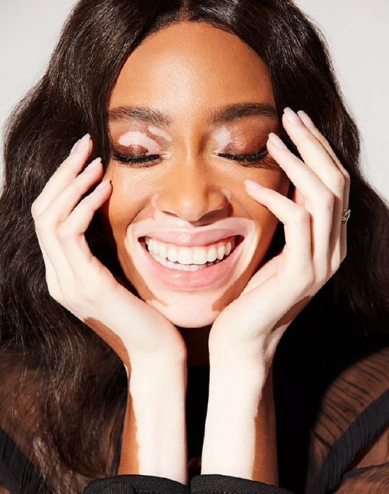 欧美美女名模Winnie Harlow Remix杂志封面大片 2