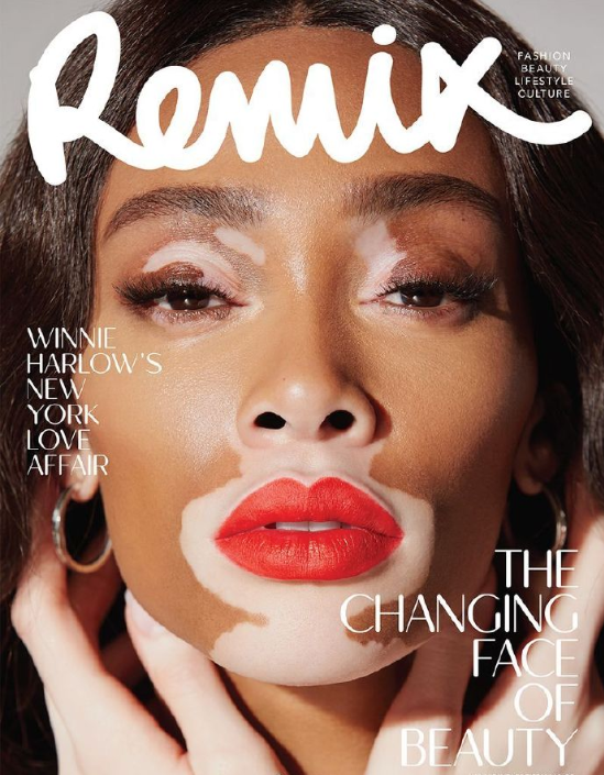 欧美美女名模Winnie Harlow Remix杂志封面大片 3