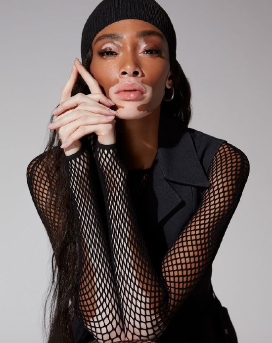 欧美美女名模Winnie Harlow Remix杂志封面大片 6