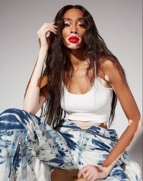 欧美美女名模Winnie Harlow Remix杂志封面大片 8