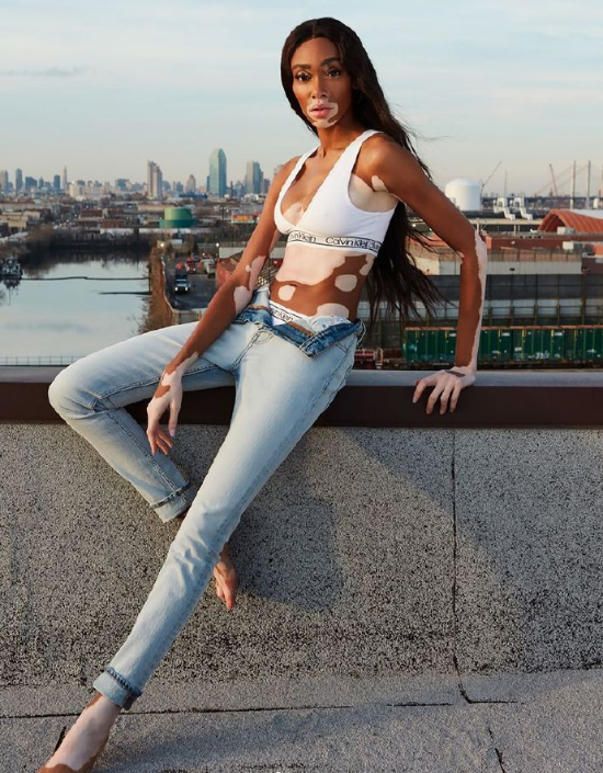 欧美美女名模Winnie Harlow Remix杂志封面大片 9