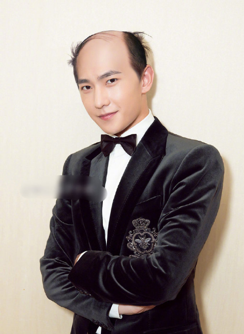 如果你的男神秃顶了 你还喜欢吗 发型对颜值有多 4