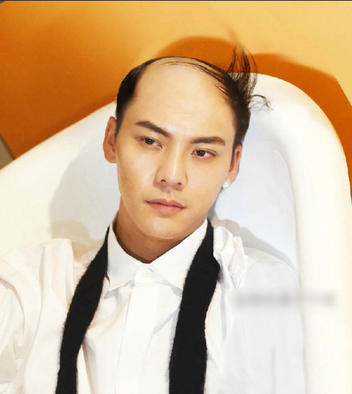 如果你的男神秃顶了 你还喜欢吗 发型对颜值有多 7